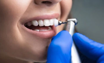 Root Canal Treatment in Kandivali